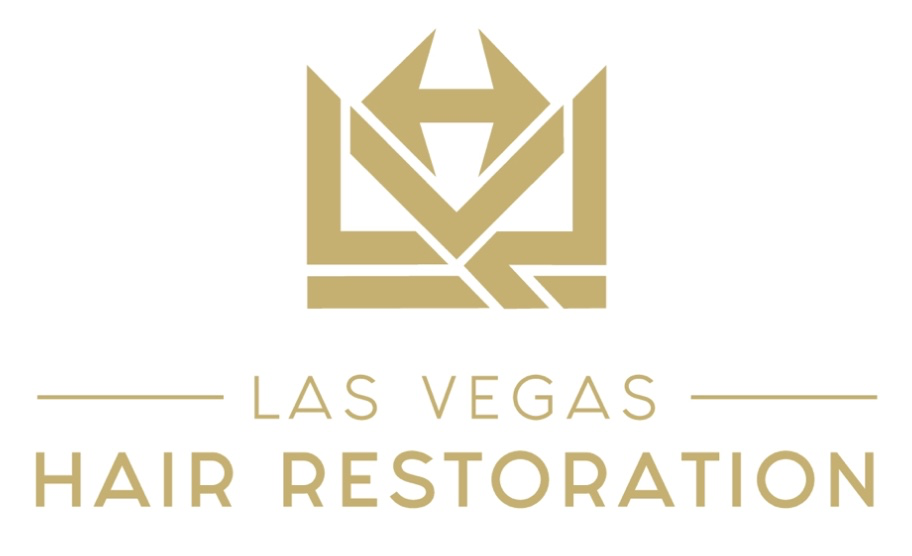 Free Consultation Las Vegas Hair Restoration